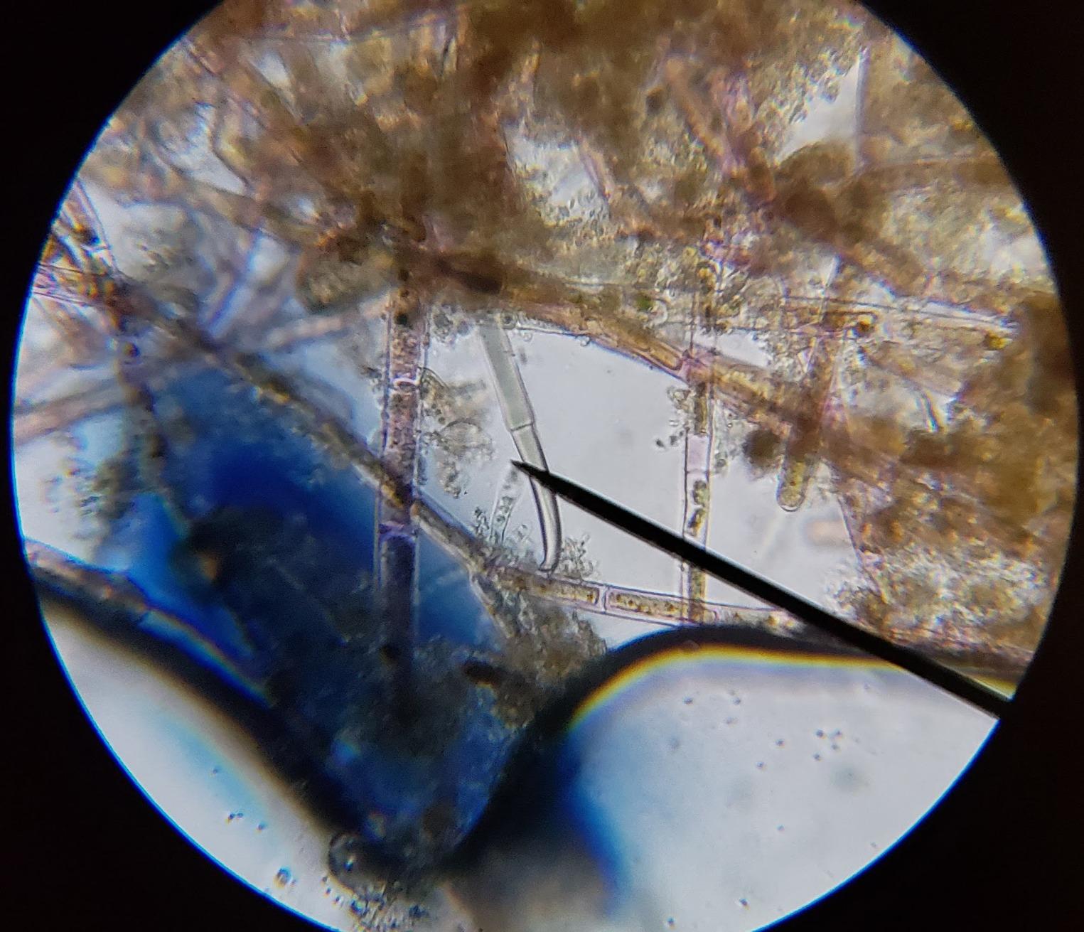 AmScope M150C 40X-1000X All-Metal Optical Glass Lenses Cordless LED Compound Biological Microscope, All-Metal Construction, Cordless Battery Powered customer photo 2