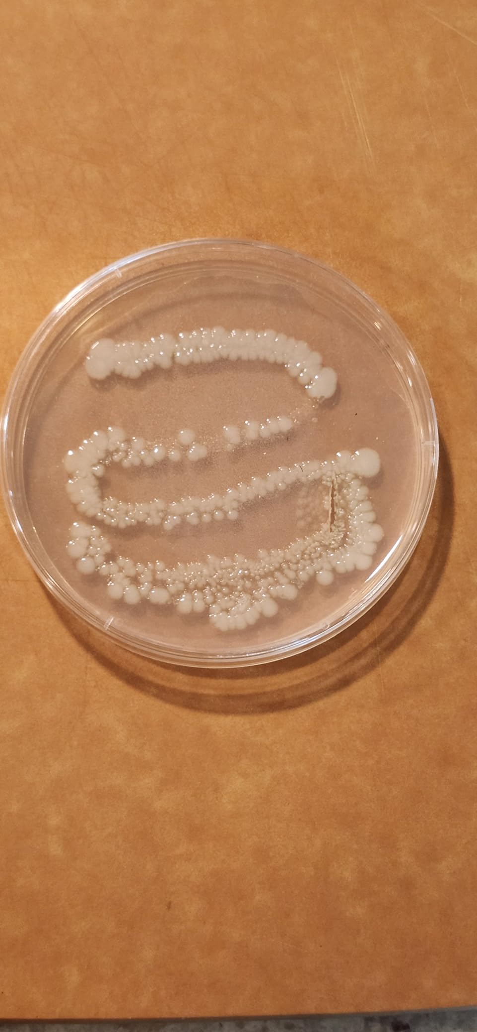 Evviva Sciences Microbiology Science Project Kit, Pre-Poured Agar Plates for Students, Agar Petri Dishes to Learn Microbiology, with Educational Experiment eBook customer photo 1