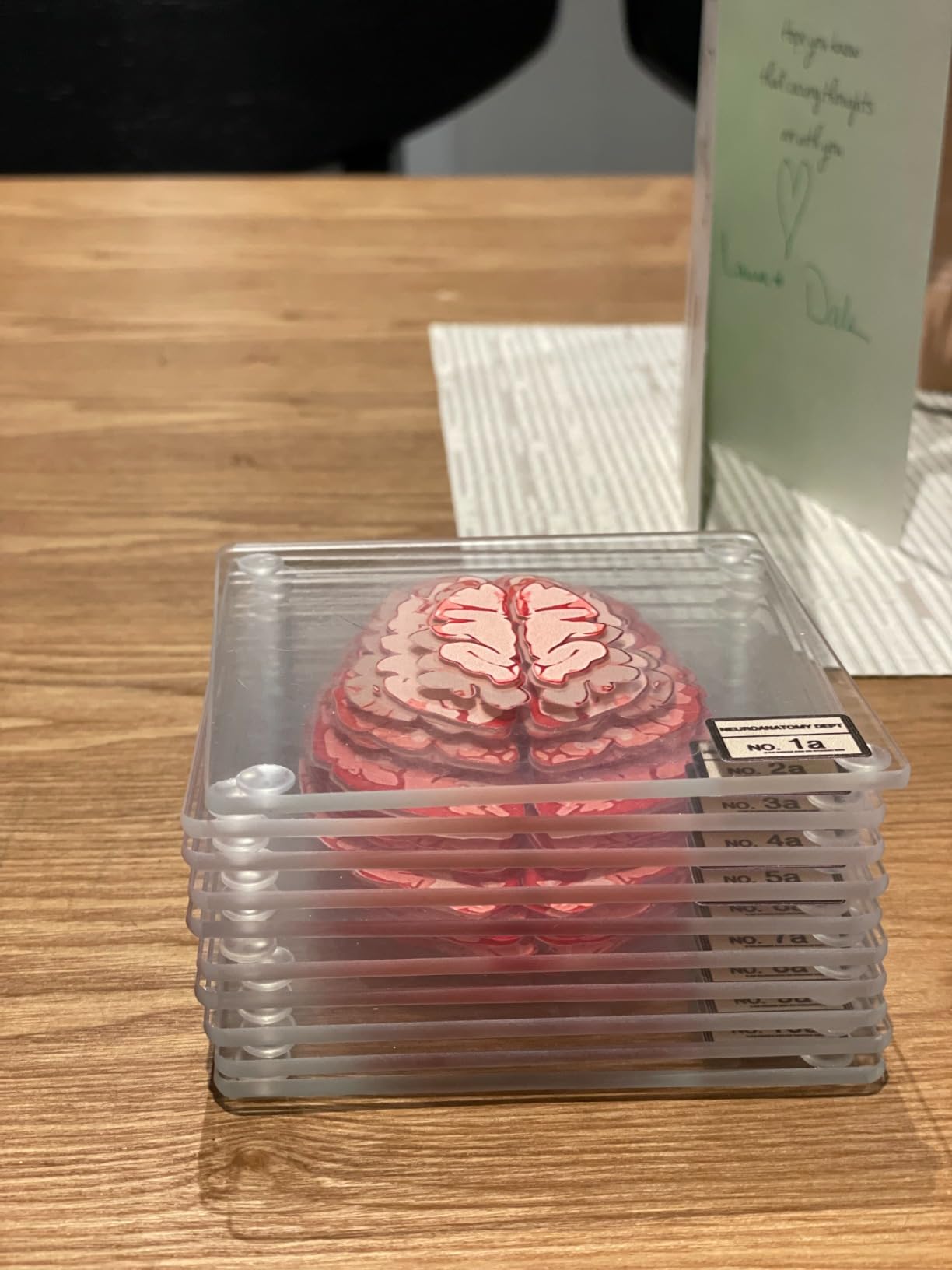ThinkGeek Anatomic Brain Specimen Coasters Set of 10 for Neuroscience Medical Student Gifts Human Anatomy customer photo 1