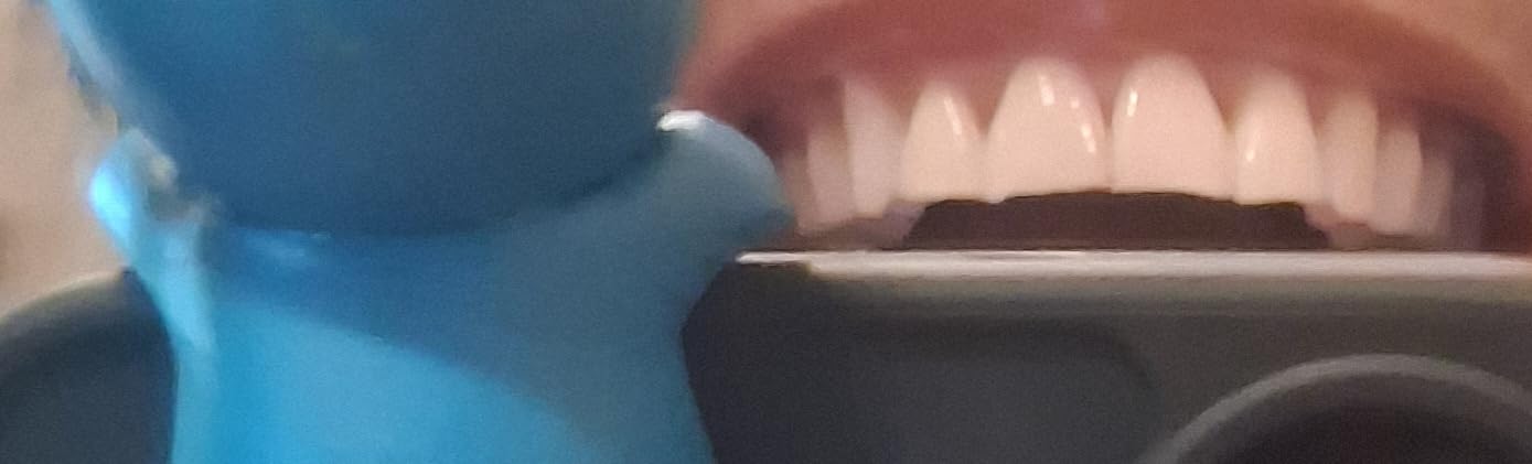 Crest 3D Whitestrips Sensitive & Gentle + LED Light - Teeth Whitening Kit, 1 Light + 14 Treatments, Each with 1 Upper/1Lower, 28 Strips - Crest 3DWhite Teeth Whitening Strips customer photo 2
